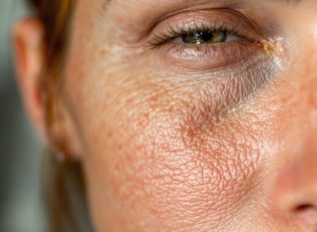 skin inflammation