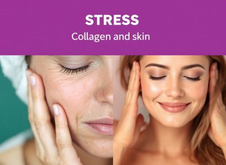 stress collagen