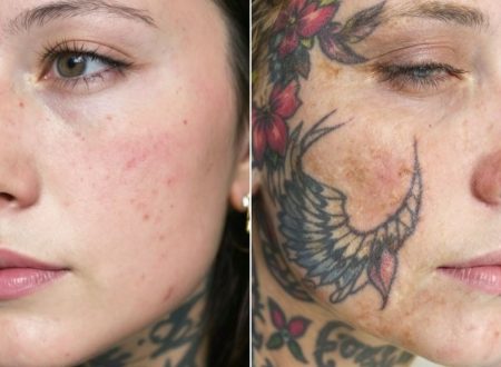 tattoo aging