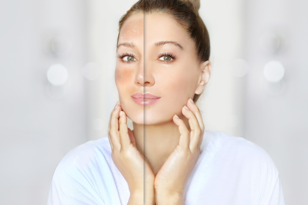Zinc and Selenium Skin Benefits