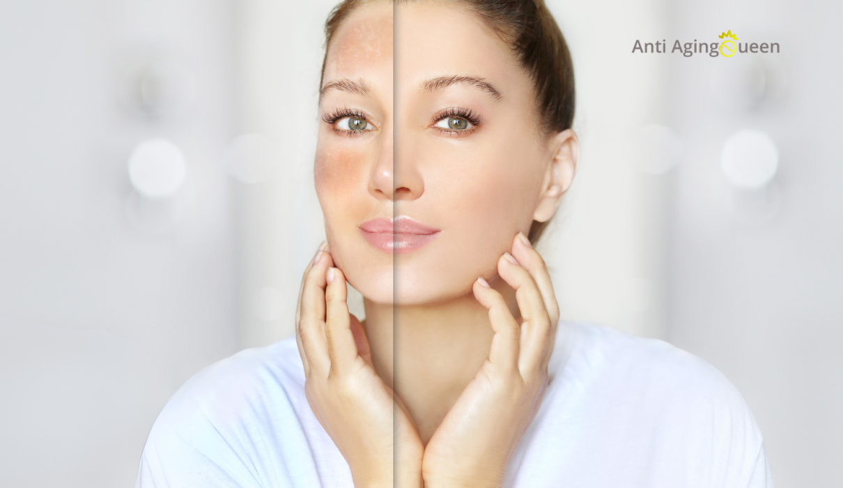 vitamin k for aging skin