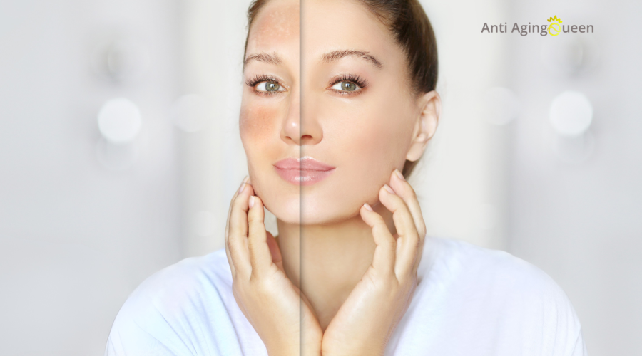 vitamin k for aging skin