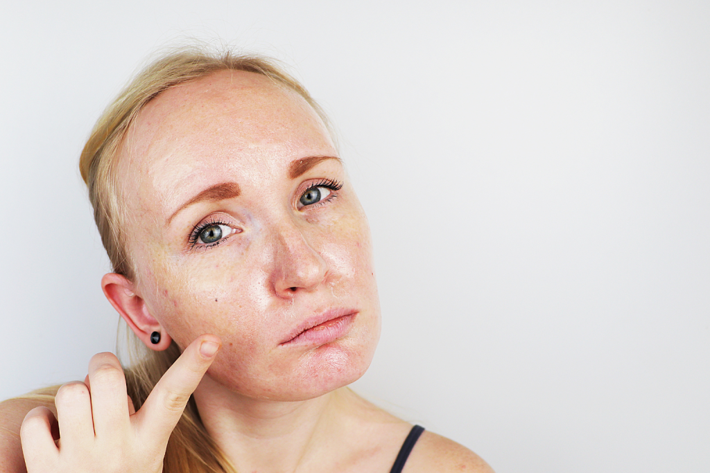 dull and tired skin 
