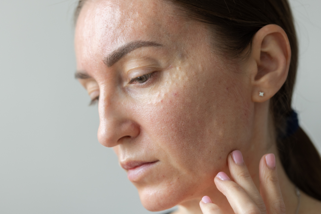 skin irritation